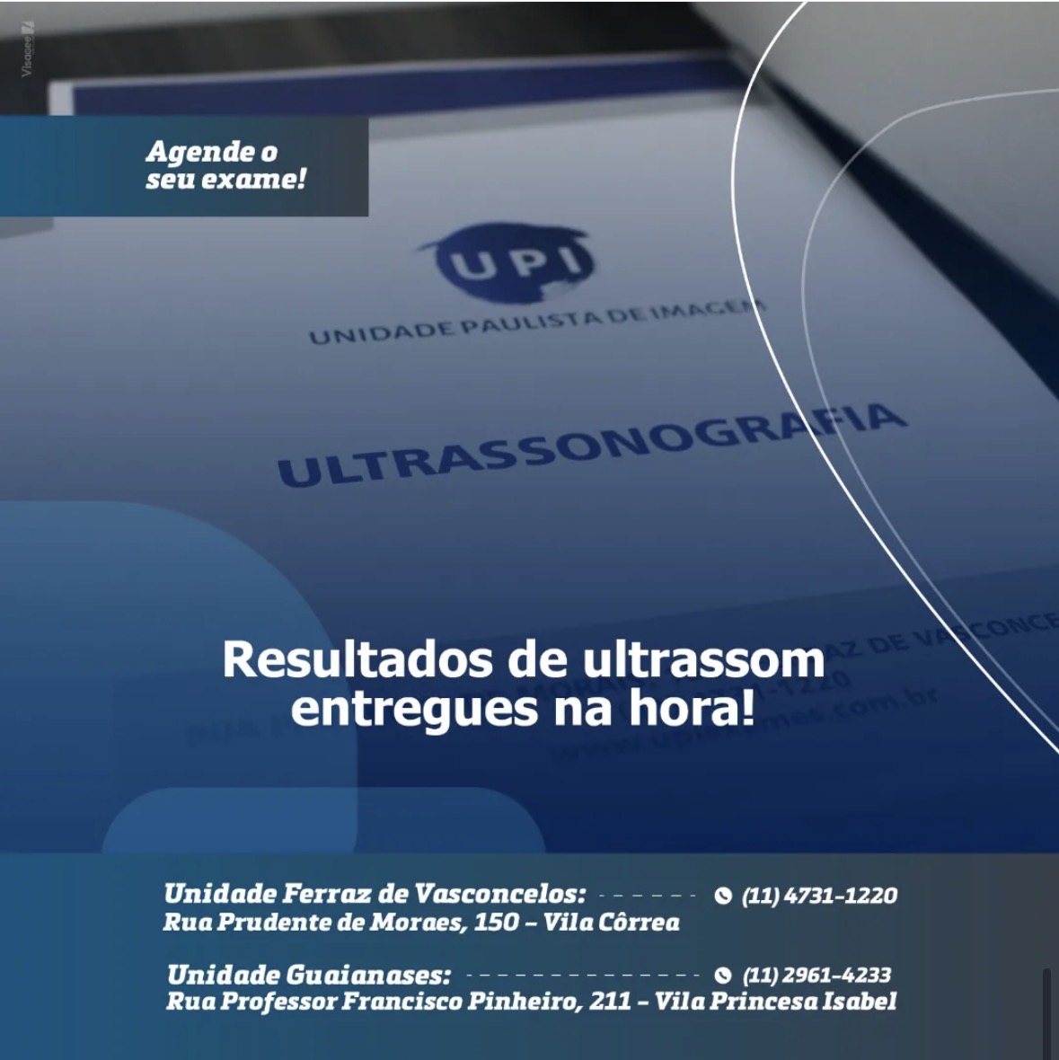 Ultrassom